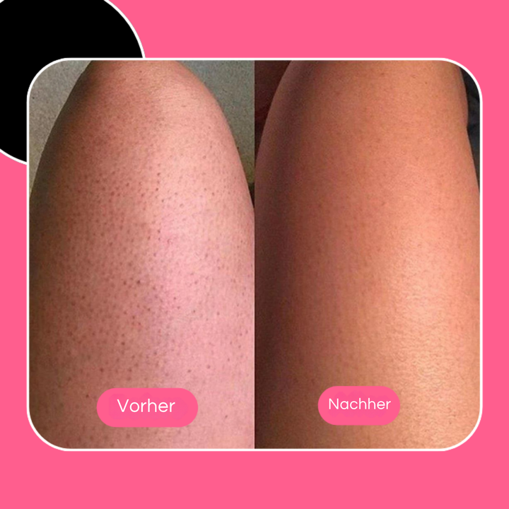 Ultrasanfter Peeling-Badeschwamm | Ohne Peeling &amp; Duschgel nutzbar | Für glattere, frischere Haut | Ideal bei empfindlicher Haut