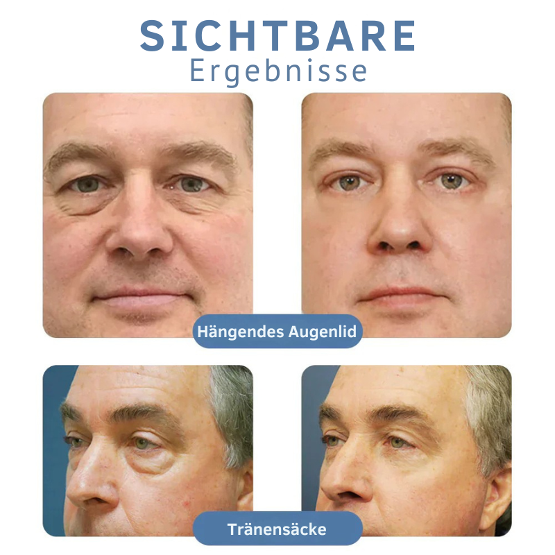 Peptid Lifting Augengel gegen Augenringe &amp; Schwellungen | mit Kojisäure &amp; Koffein | glättet feine Linien, strafft &amp; hydratisiert | 1+1 Gratis