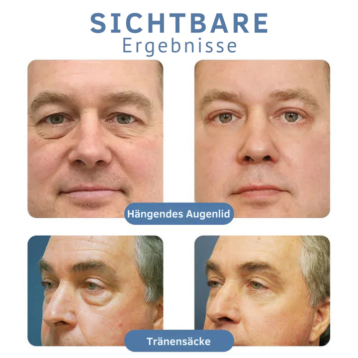 Peptid Lifting Augengel gegen Augenringe &amp; Schwellungen | mit Kojisäure &amp; Koffein | glättet feine Linien, strafft &amp; hydratisiert | 1+1 Gratis
