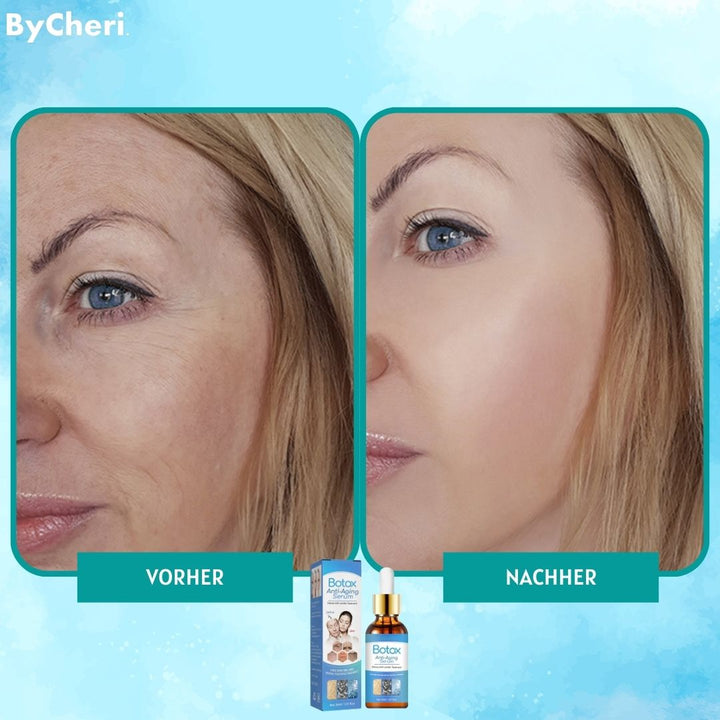 GlowTight™ Lifting serum | Firming &amp; moisturizing anti-aging serum | For smoother &amp; more elastic skin