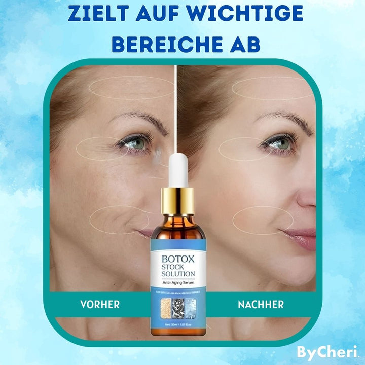 GlowTight™ Lifting serum | Firming &amp; moisturizing anti-aging serum | For smoother &amp; more elastic skin
