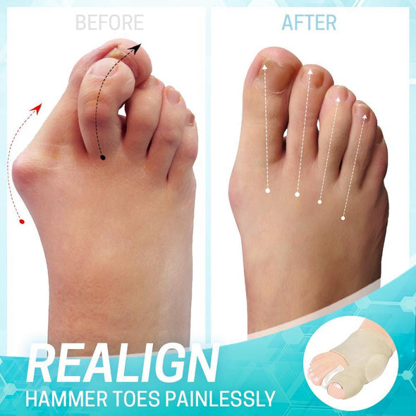 Bunion correction sleeve with gel pad | Toe aligner &amp; pressure relief | Thin, breathable &amp; wearable in shoes, 2 pairs