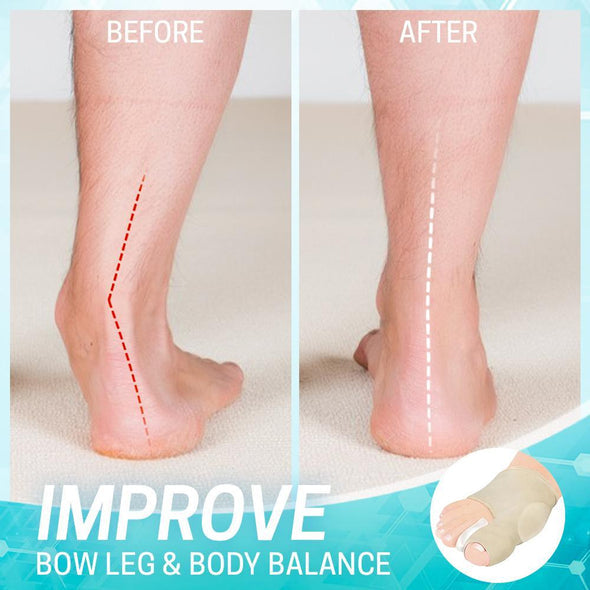 Bunion correction sleeve with gel pad | Toe aligner &amp; pressure relief | Thin, breathable &amp; wearable in shoes, 2 pairs