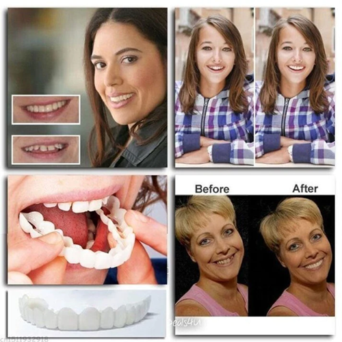 Adjustable Snap-On Tooth Cover | Flexible &amp; Comfortable for a Natural Smile | Reusable, Removable, DIY Customization