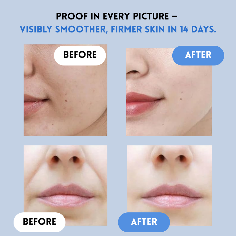 JugendLifting™ Lifting jeunesse instantané
