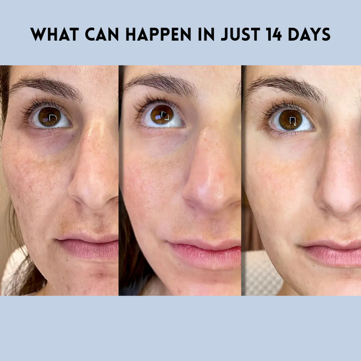 JugendLifting™ Lifting jeunesse instantané