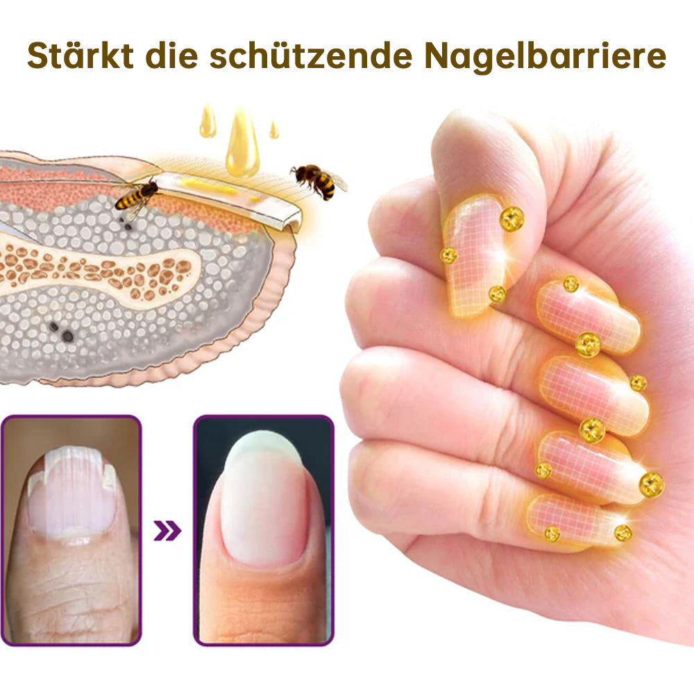 1+1 ZDARMA | PilzSchutzschild™ Odstraňuje plesne na nechtoch