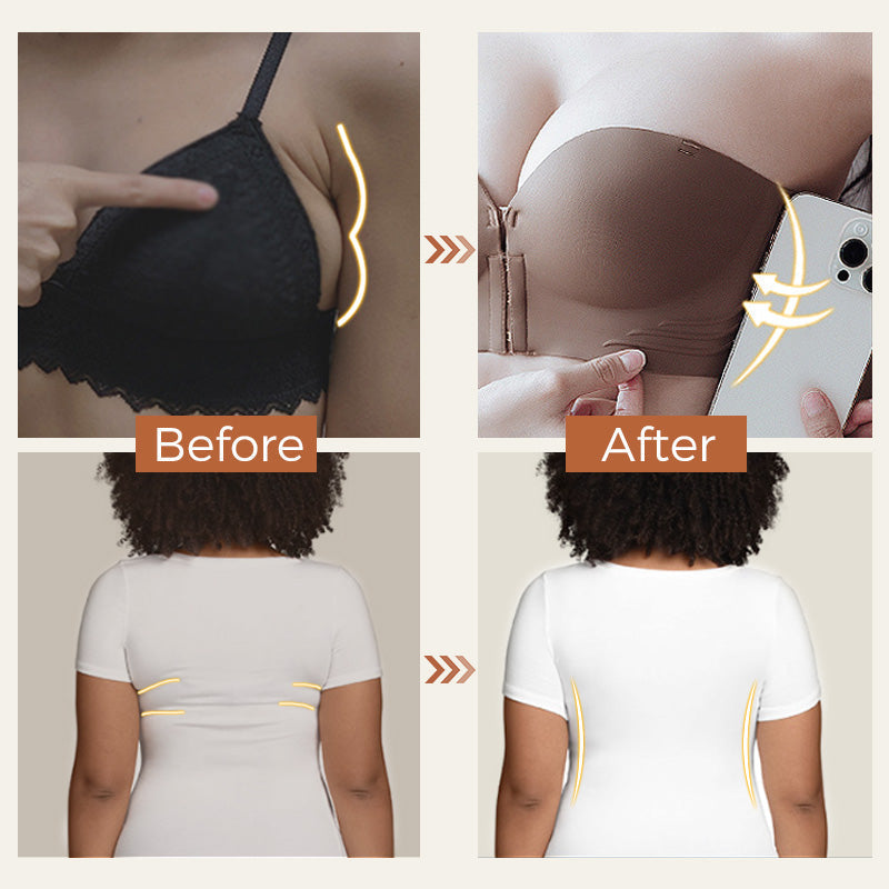 Irene™ Support without straps