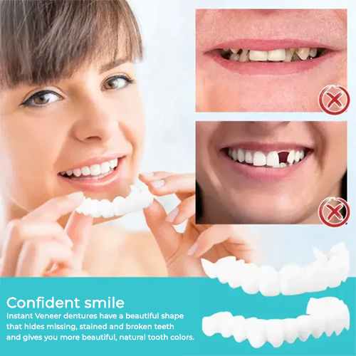 Adjustable Snap-On Tooth Cover | Flexible &amp; Comfortable for a Natural Smile | Reusable, Removable, DIY Customization