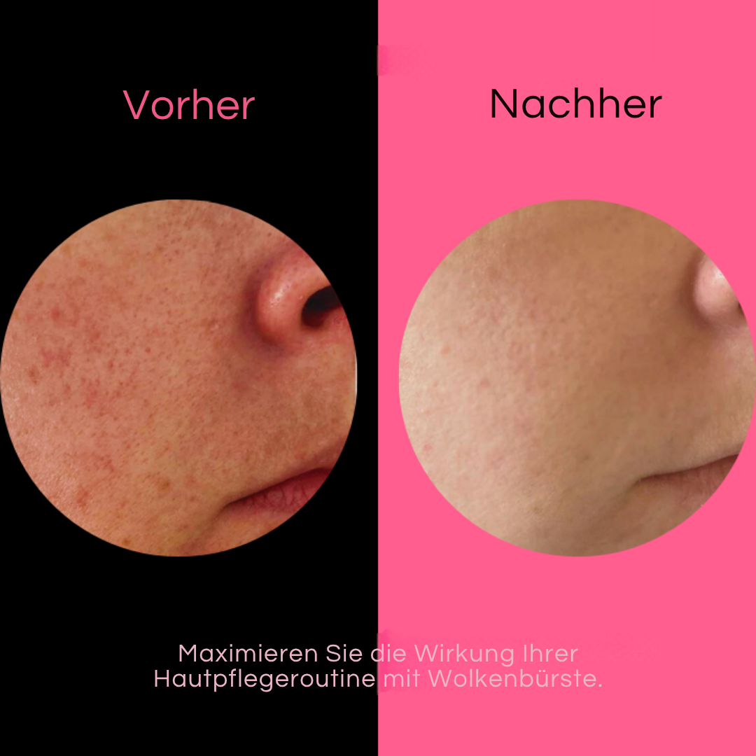 Ultrasanfter Peeling-Badeschwamm | Ohne Peeling &amp; Duschgel nutzbar | Für glattere, frischere Haut | Ideal bei empfindlicher Haut
