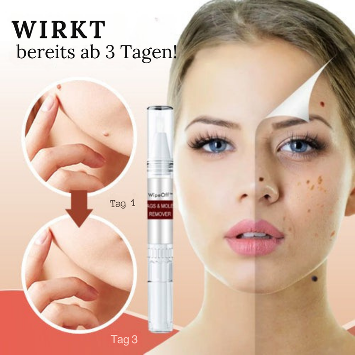 Skin spot care serum 3 ml | Precision applicator for targeted application | Quick-drying &amp; hygienic | For home use