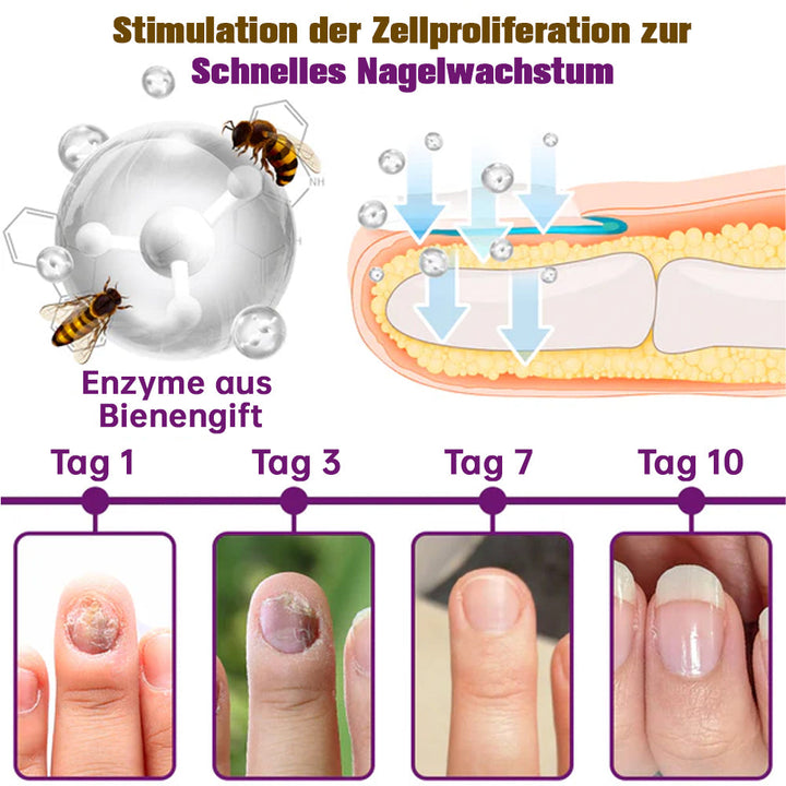 1+1 ZDARMA | PilzSchutzschild™ Odstraňuje plesne na nechtoch