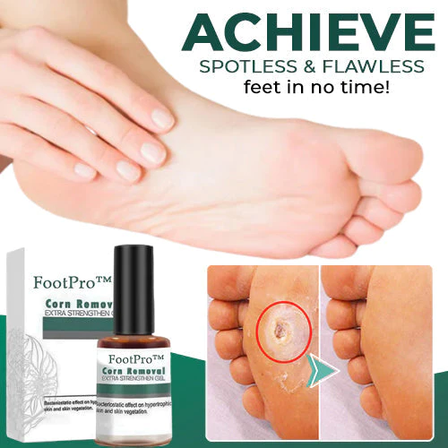 1+1 Free | SmoothFeet™ Softens hard skin