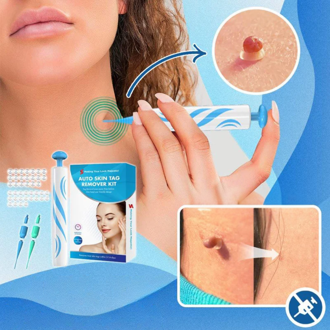 WartCleaner™ | Skincare set for removing skin impurities &amp; warts | Gentle &amp; easy