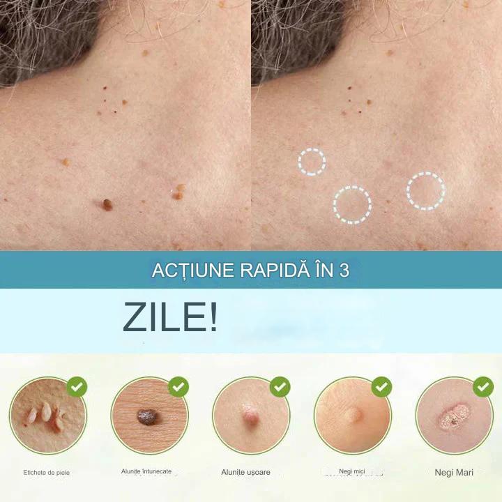 Priehľadné kožné náplaste 6,5 x 9,6 cm | Diskrétne a pohodlné na kožu | Jednoduché použitie, šetrné k pokožke