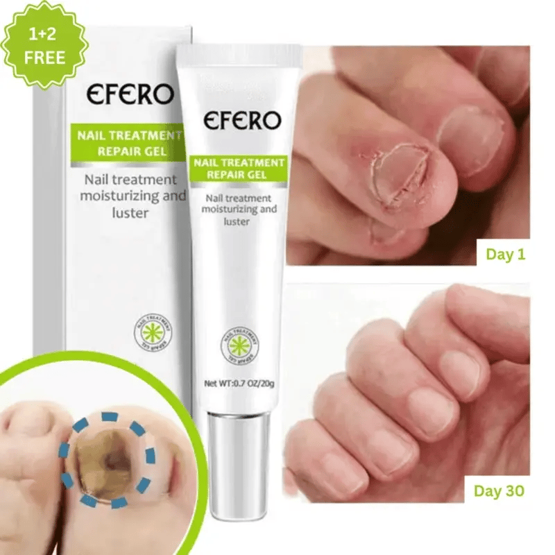 Efero® gel réparateur pour ongles : 1 + 2 GRATUITS – Offre temporaire