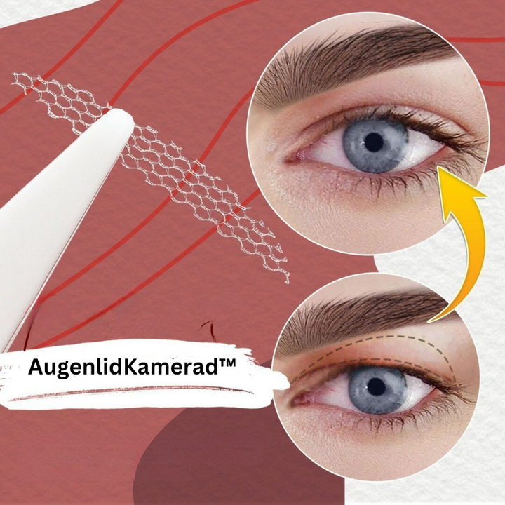 EyelidBuddy™ Seamless lift effect