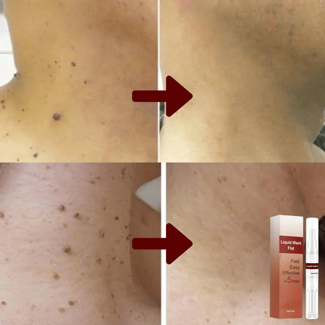 Pflegendes Hautserum 3 ml mit Teebaumöl &amp; Kräuterextrakten | Für Gesicht &amp; Körper | Schnell einziehend | Für alle Hauttypen