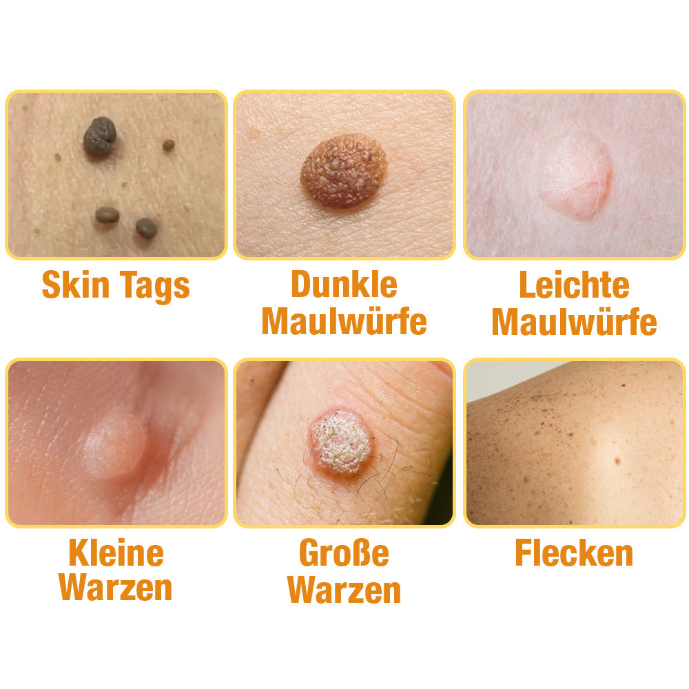 Pflegespray mit Bienengift-Extrakt | Beruhigt &amp; spendet Feuchtigkeit | Für glatter wirkende Haut, 30 ml, schnelle Anwendung
