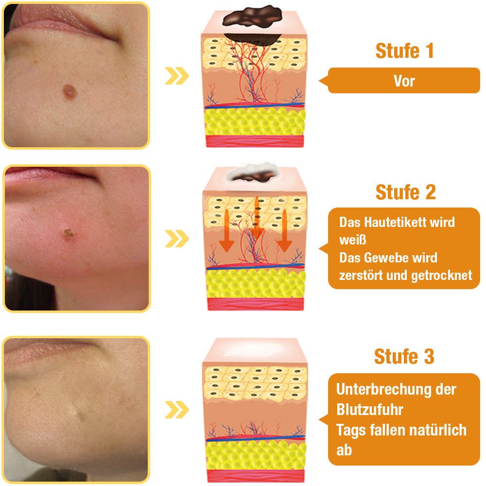 Pflegespray mit Bienengift-Extrakt | Beruhigt &amp; spendet Feuchtigkeit | Für glatter wirkende Haut, 30 ml, schnelle Anwendung
