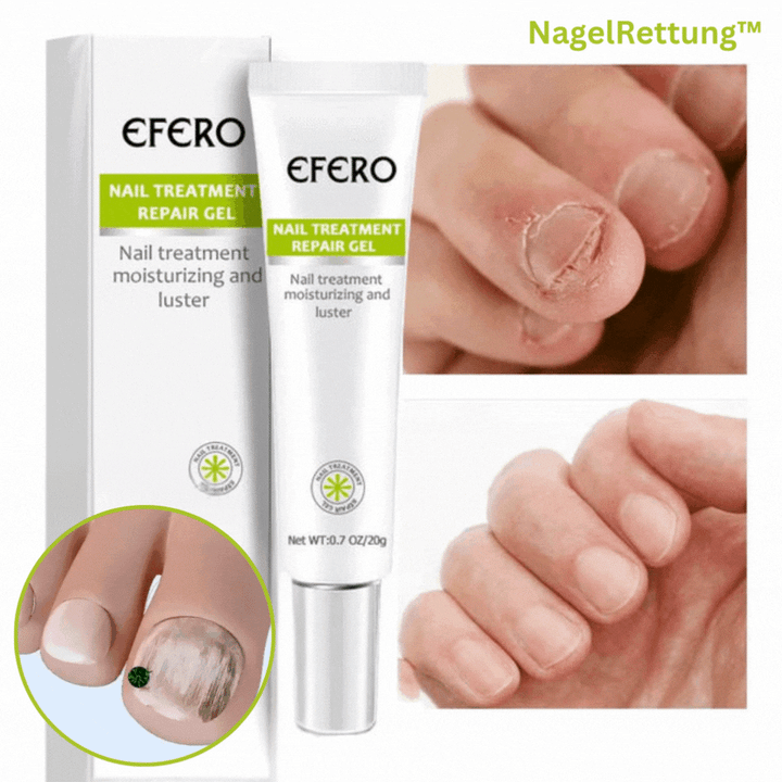 Nagelpflege-Gel für verfärbte &amp; spröde Nägel | Unterstützt gepflegtes Aussehen | Einfaches Auftragen, schnelltrocknend | 3er-Set