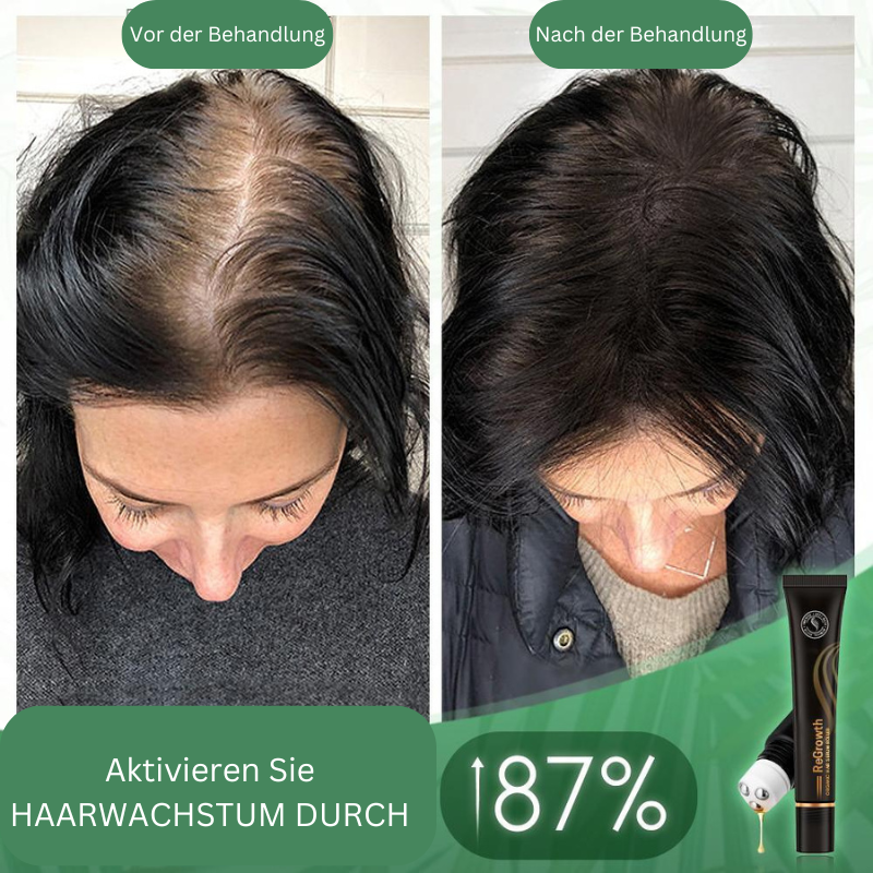 Organic Hair Serum Roller for Scalp | With Herbal Extracts, Non-Greasy | Easy to Apply &amp; Massage In | 20 ml (1+1 Set)