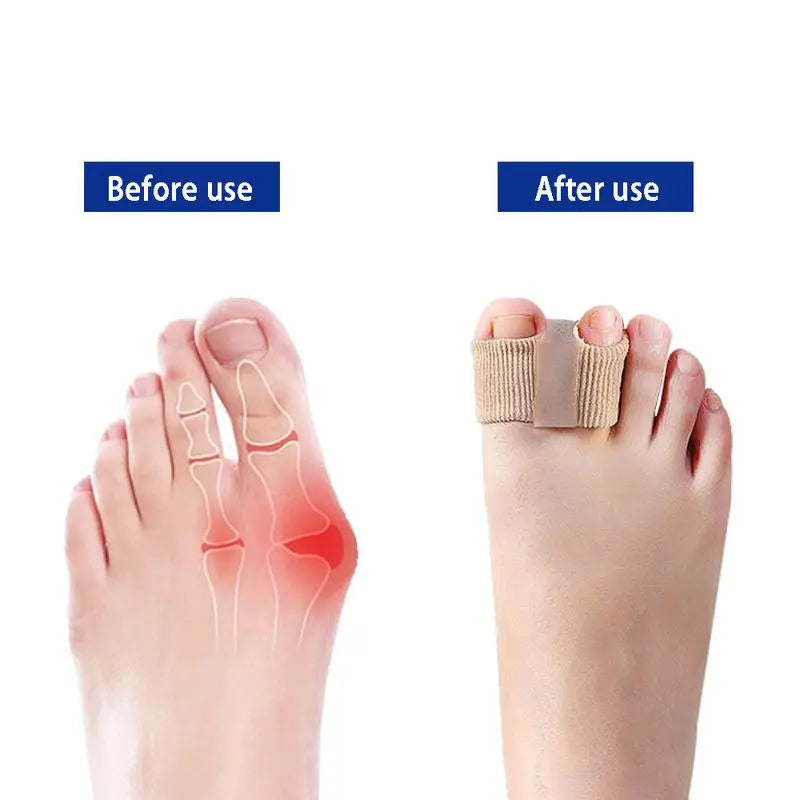 Premium Toe Separator | Elastic separators for bunions &amp; misalignments | Nylon &amp; SEBS