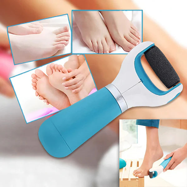 Lima elettrica per piedi | Rimuovi calli | Pedicure delicata con microgranuli | Ricaricabile e delicata sulla pelle
