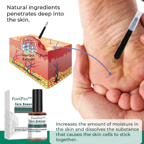 1+1 Free | SmoothFeet™ Softens hard skin