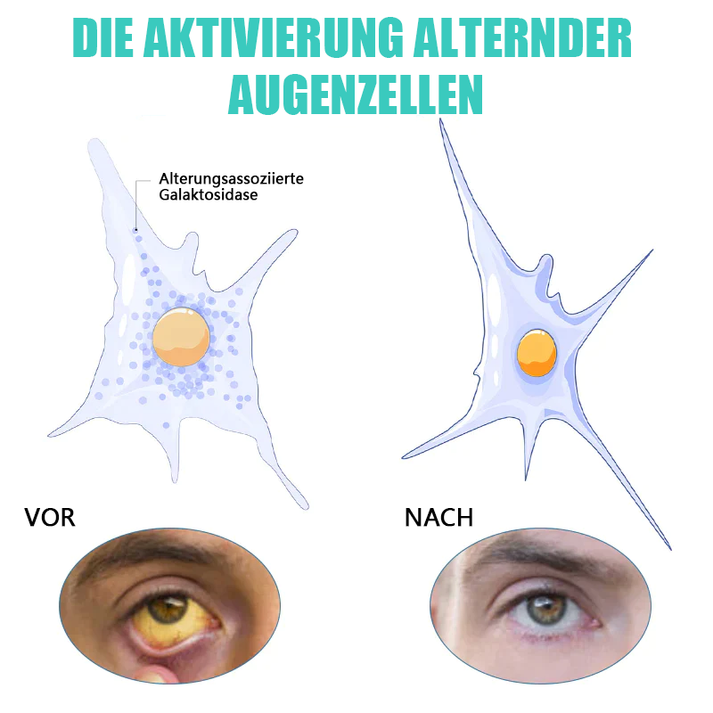 KlarTropfen™ Rötung Schnell Lindern