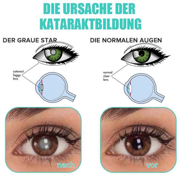 KlarTropfen™ Rötung Schnell Lindern