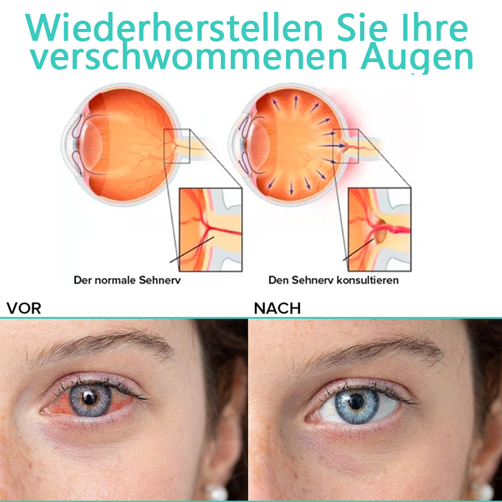 KlarTropfen™ Rötung Schnell Lindern