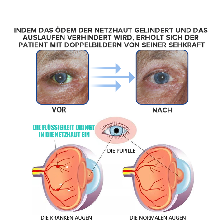 KlarTropfen™ Rötung Schnell Lindern