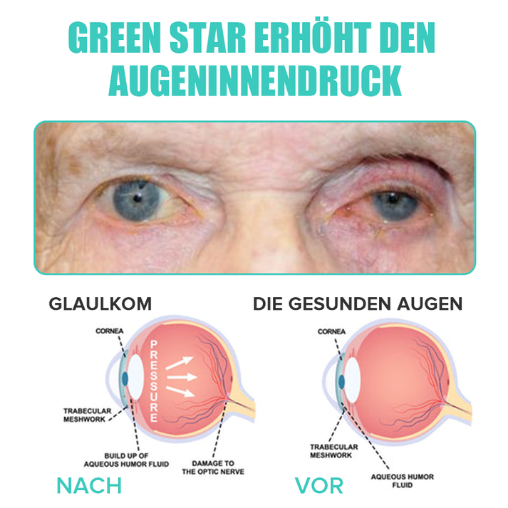 KlarTropfen™ Rötung Schnell Lindern