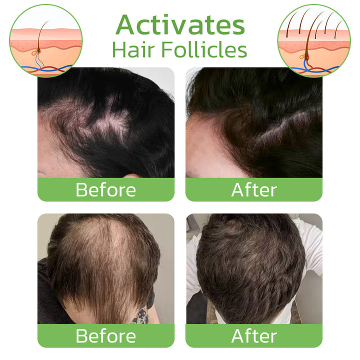 Nährendes Ingwer-Haarspray 100 ml | Kopfhaut-Pflege bei dünner werdendem Haar | Mit Ingwerextrakt, Procapil &amp; Ginkgo, einfache Anwendung