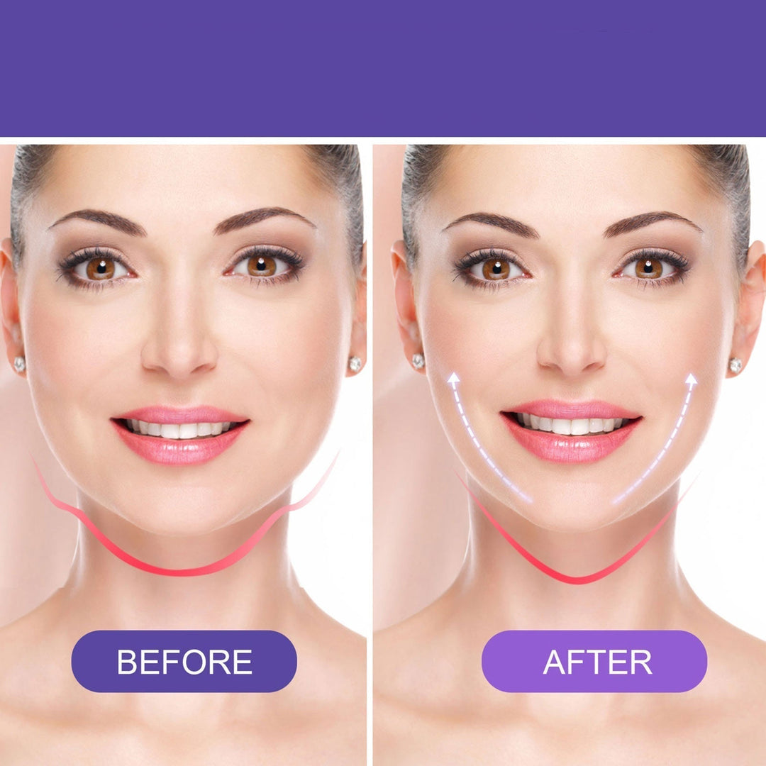 LiftingViso™ Leviga le rughe d&
