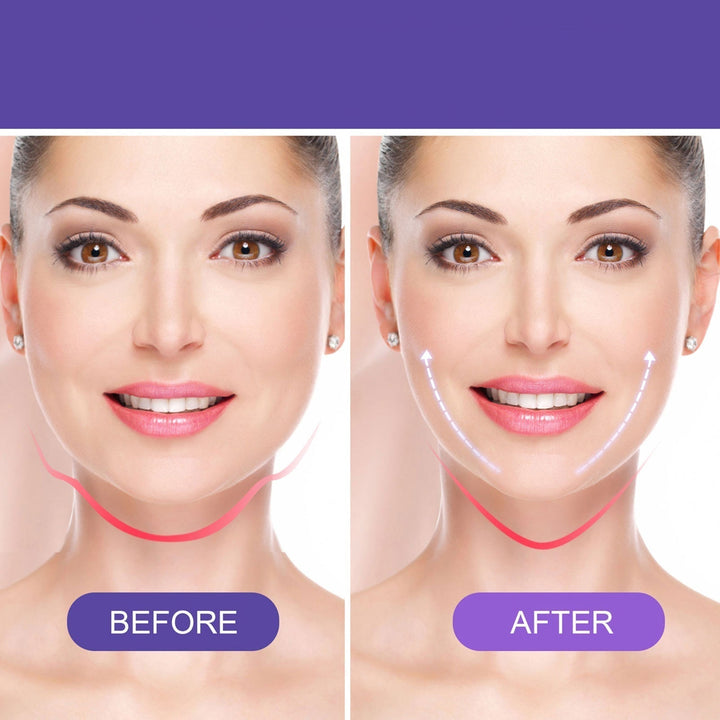 LiftingViso™ Leviga le rughe d&