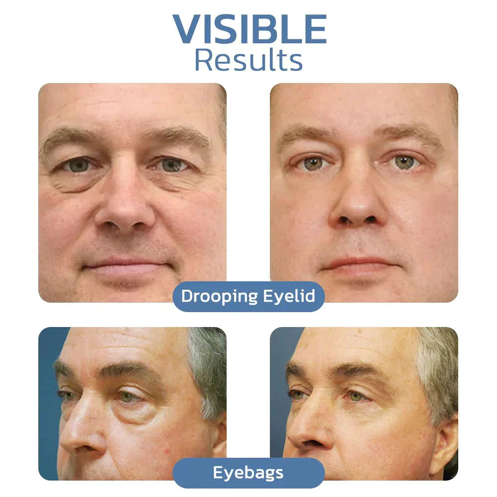 EyeRefresh™ Peptide firming eye gel