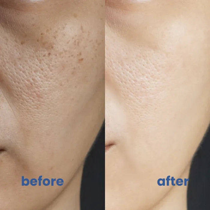 SkinBlend™ Instantly Neutralizes Redness