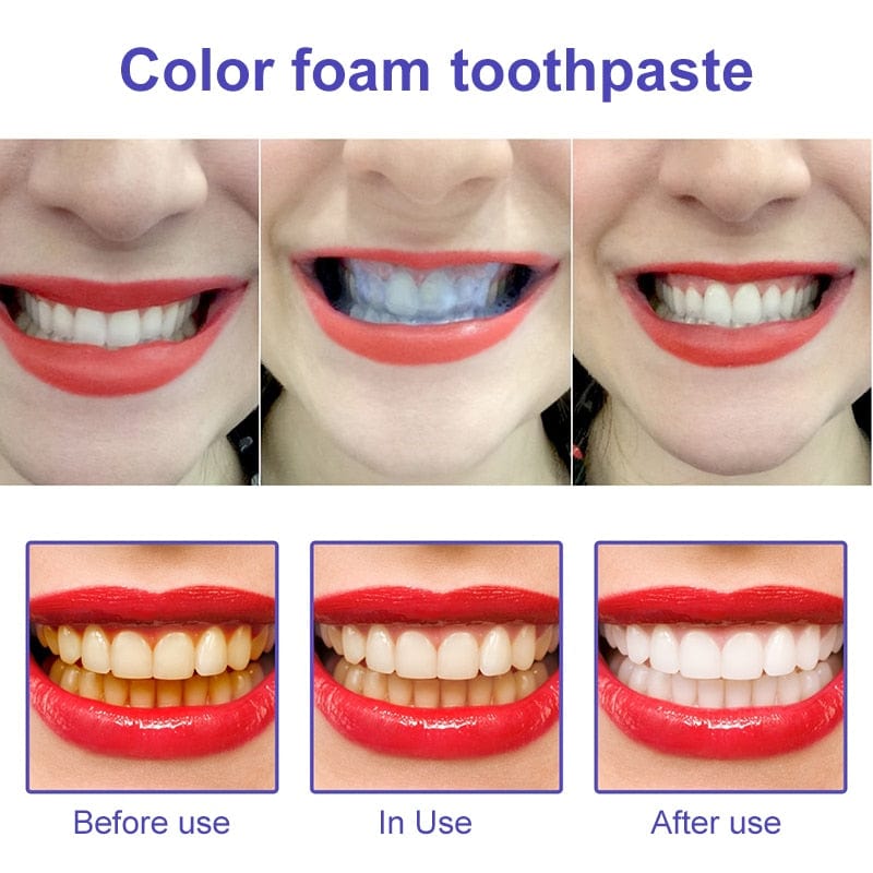 Lila Whitening Zahnpasta für sichtbar hellere Zähne | Zahnaufhellung &amp; Plaque-Entfernung | Frischer Atem &amp; tägliche Mundpflege